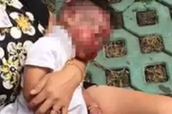 被母亲砍伤9岁男孩已脱离危险，呼唤家庭关爱与社会关注