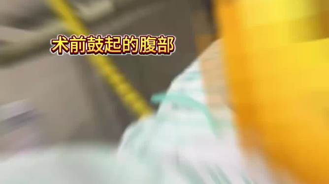 女子便秘长达二十多年，肚子险撑爆，揭示背后的健康危机